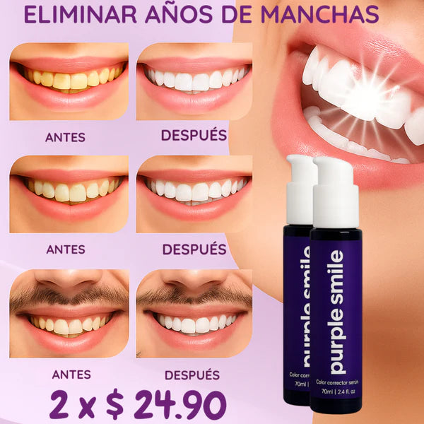 💜 Purple Smile – Espuma Dental Blanqueadora Correctora de Color 💜